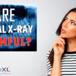 ARE DENTAL X-RAYS HARMFUL?