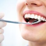 5 SURPRISING FOODS AND DRINKS THAT BENEFIT YOUR ORAL HEALTH