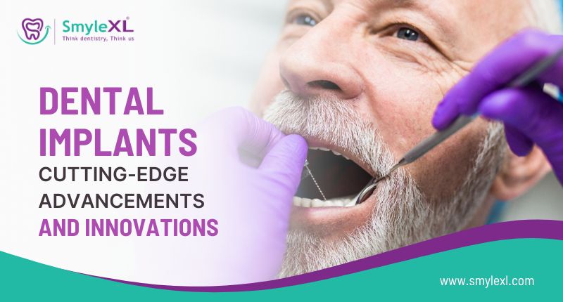 Dental Implants: Cutting-Edge Advancements and Innovations