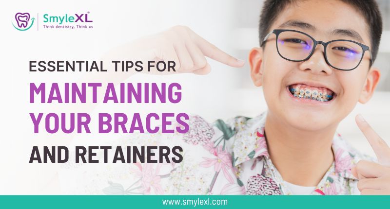 Essential Tips for Maintaining Your Braces and Retainers