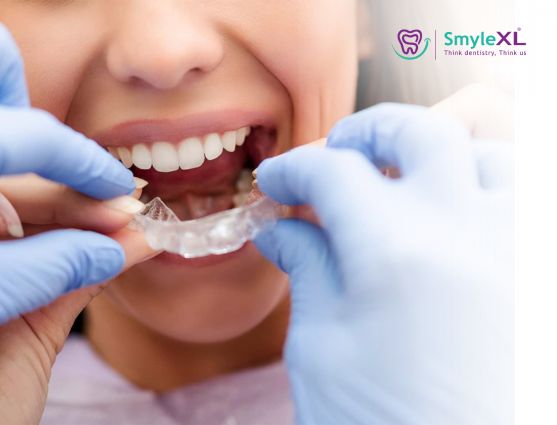 Invisible braces treatment in viman nagar