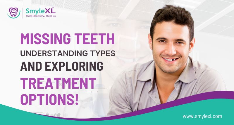 Missing Teeth: Types and Effective Treatment Solutions