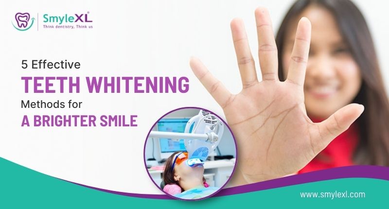 5 Effective Teeth Whitening Methods for a Brighter Smile