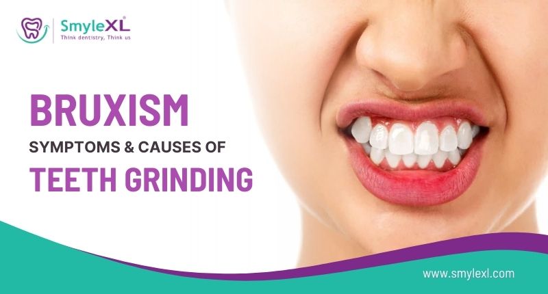 Bruxism Symptoms and Causes of Teeth Grinding