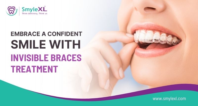 Embrace a Confident Smile with Invisible Braces Treatment