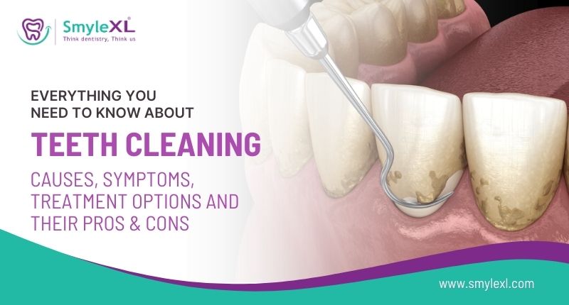 Everything You Need to Know About Teeth Cleaning: Causes, Symptoms, Treatment Options, and Their Pros and Cons