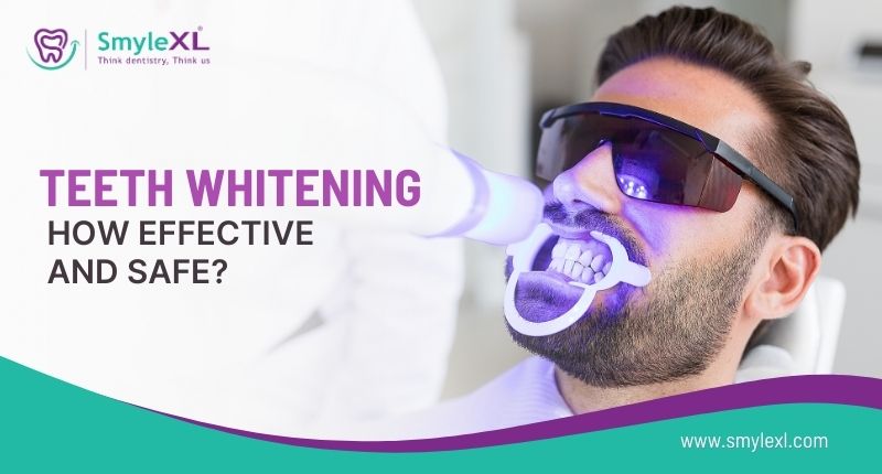 Teeth Whitening:How Effective and Safe?