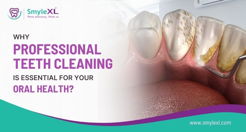 Why Professional Teeth Cleaning is Essential for Your Oral Health