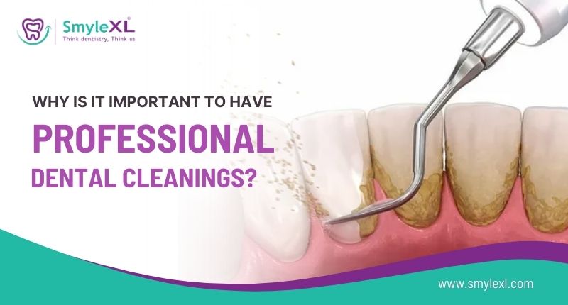 Why is it Important to Have Professional Dental Cleanings?