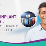 Dental Implant Surgery: Recovery Journey and Side Effect