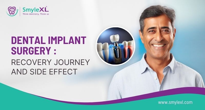 Dental Implant Surgery: Recovery Journey and Side Effect