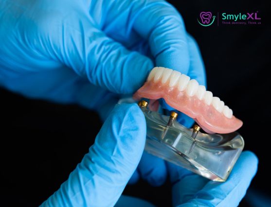 Denture Treatment in Ahmednagar