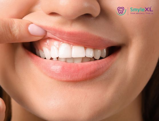 Gum Treatment in Ahmednagar