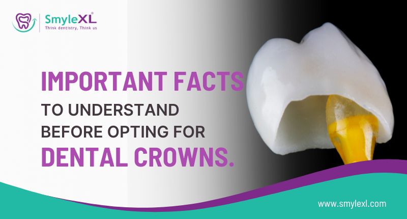 Important Facts to Know Before Choosing Dental Crowns