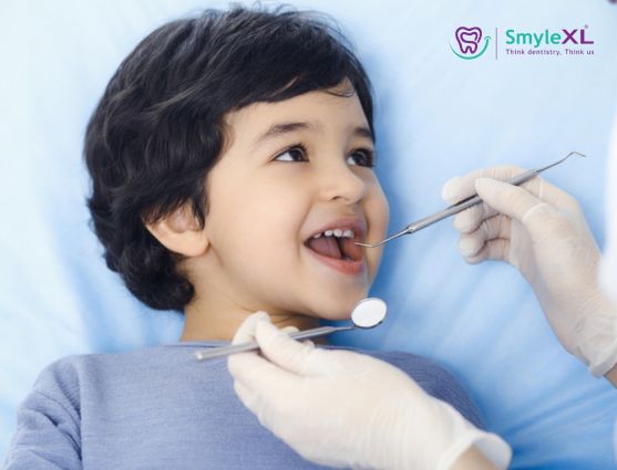 Kids Dental Treatment in Kondhwa