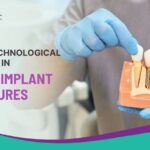 Latest Technological Advances in Dental Implant Procedures