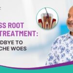 Painless Root Canal Treatment: Say Goodbye to Toothache Woes