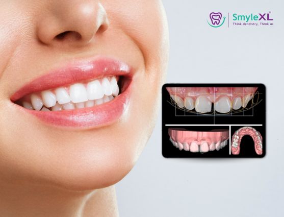 Smile Designing Treatment in Ahmednagar