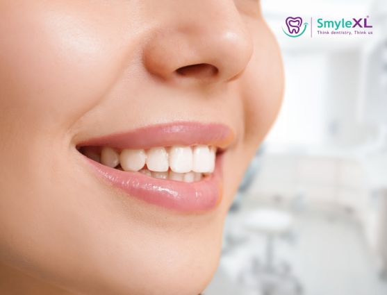 Smile Makeover Treatment in Ahmednagar