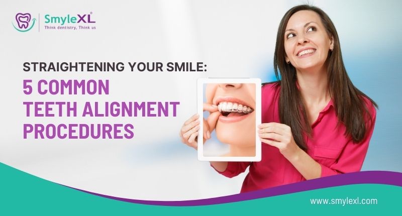 Straightening Your Smile: 5 Common Teeth Alignment Procedures