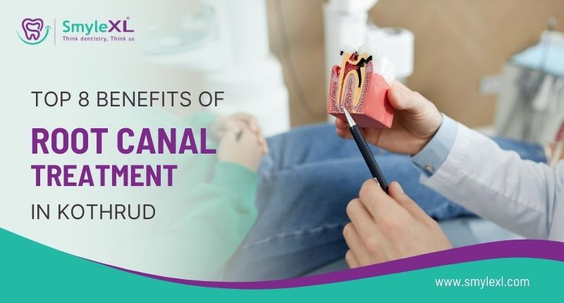 Top 8 Benefits of Root Canal Treatment in Kothrud