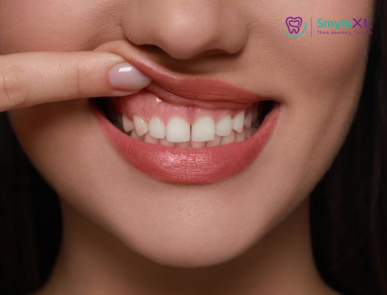 gum treatment in vijay nagar