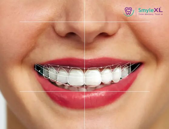 smile designing treatment in vijay nagar