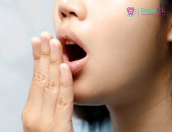 Bad Breath Treatment in Kolhapur