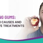 Bleeding Gums: Common Causes and Effective Treatments