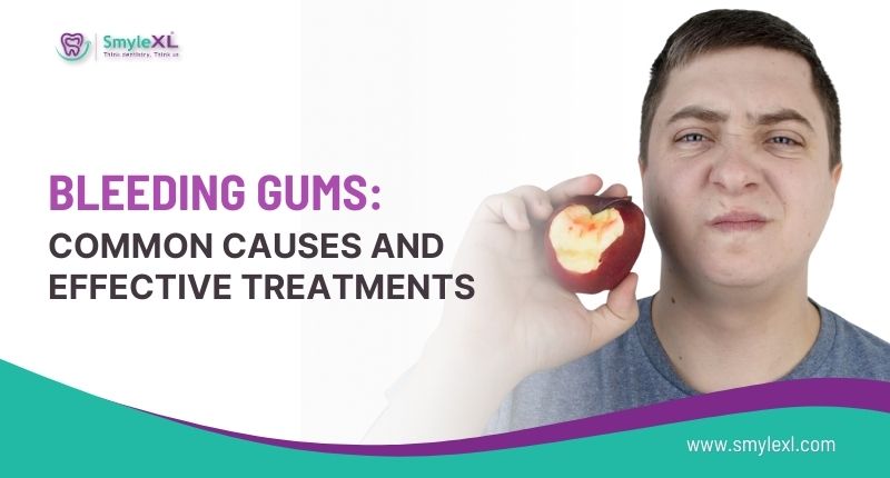 Bleeding Gums: Common Causes and Effective Treatments