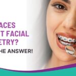 Can Braces Correct Facial Asymmetry? Here’s the Answer!