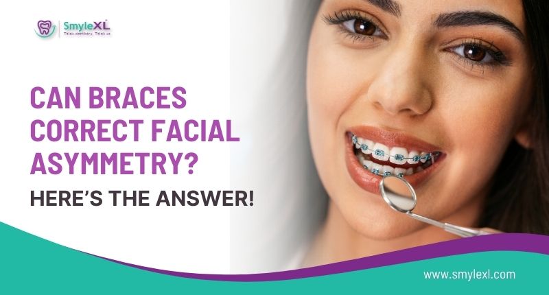 Can Braces Correct Facial Asymmetry? Here’s the Answer!