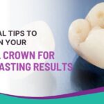 Essential Tips to Maintain Your Dental Crown for Long-lasting Results