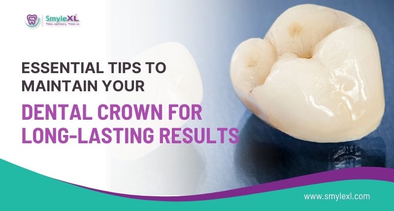 Essential Tips to Maintain Your Dental Crown for Long-lasting Results