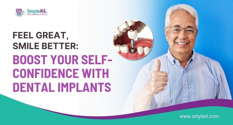 Feel Great Smile Better: Boost Your Self-Confidence with Dental Implants