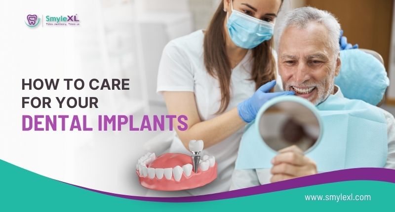 How To Care For Your Dental Implants