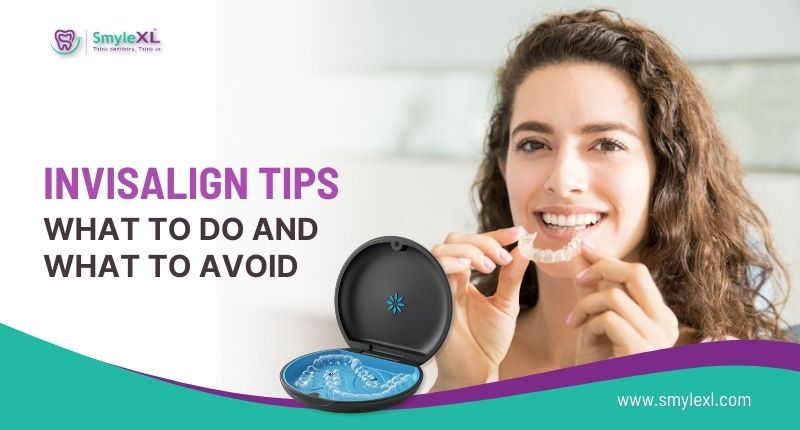 Invisalign Tips: What To Do and What To Avoid