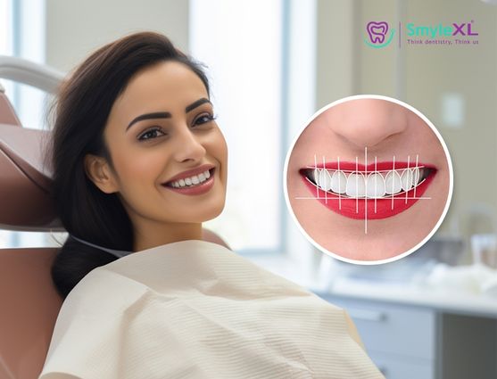 Smile Designing Treatment in Kothrud