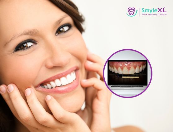 Smile Designing Treatment in Kolhapur