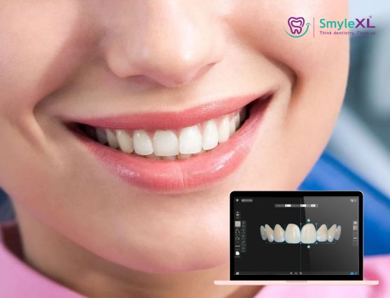 Smile Designing Treatment in Phaltan
