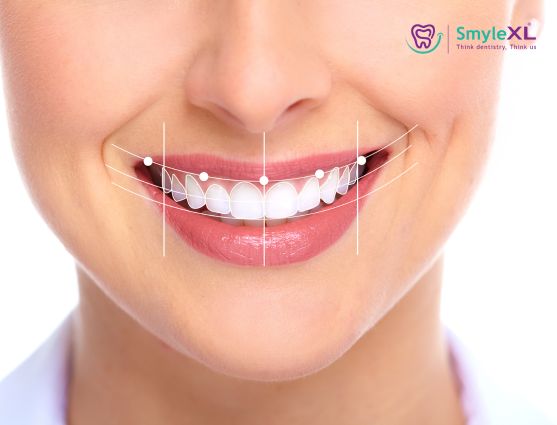 Smile Designing Treatment in RMV Bengaluru