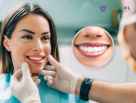 Smile Designing Treatment in Vanasthalipuram
