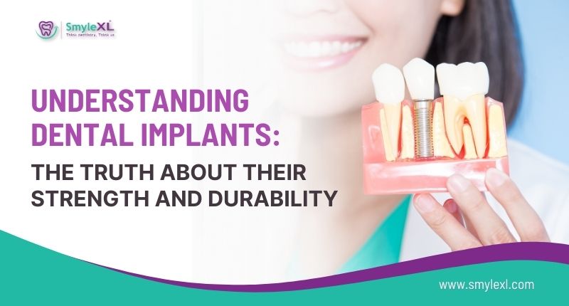 Understanding Dental Implants: The Truth About Their Strength and Durability