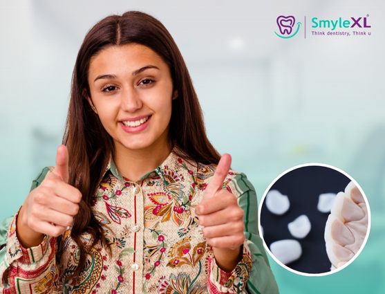 Dental Veneers Treatment in India