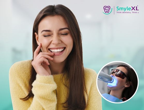 Teeth Whitening Treatment in India