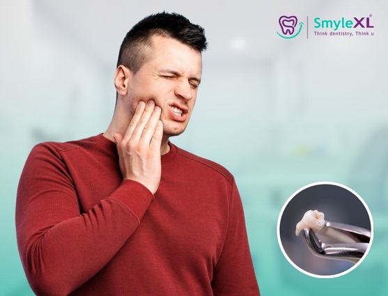 Wisdom Tooth Removal in India