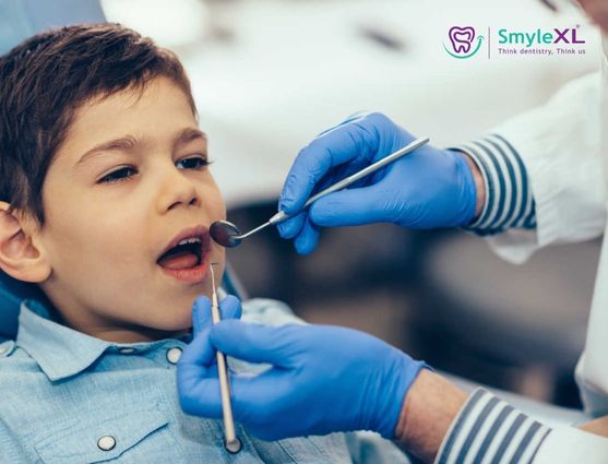 kids dental treatment in Nallagandla, Hyderabad