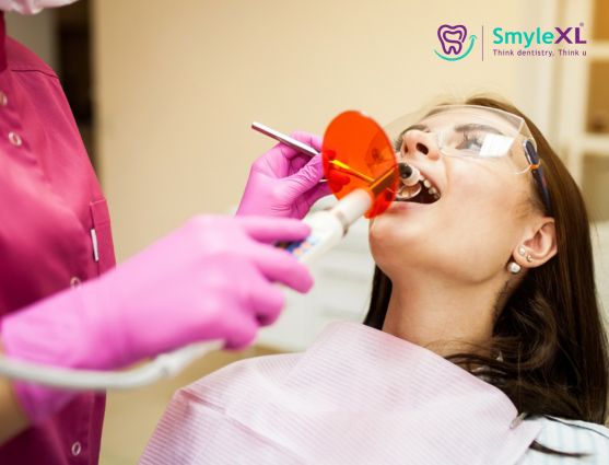 Dental Fillings Treatment in Nashik Road Nashik