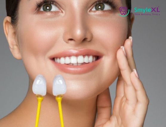 Dental Veneers Treatment in Nashik Road Nashik