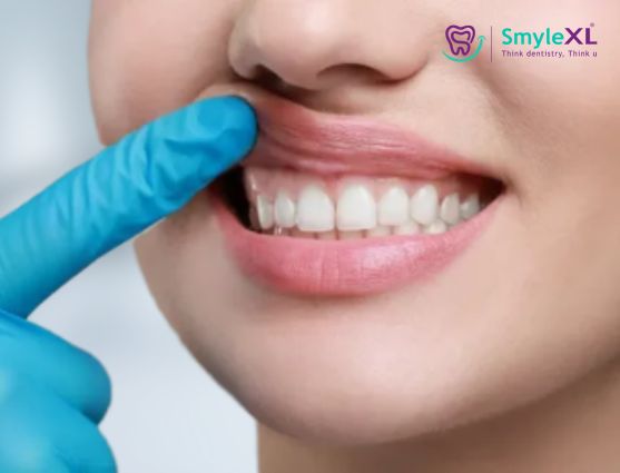 Gum Treatment in Nashik Road Nashik